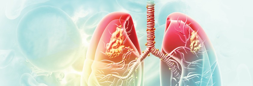 Northern Light EMMC Thoracic Oncology Conference Banner